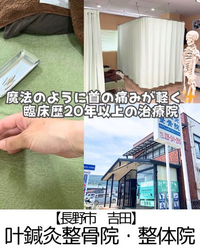 【長野市 吉田】叶鍼灸整骨院・整体院~人生初の鍼経験で魔法みたいに首の痛みが軽減!~